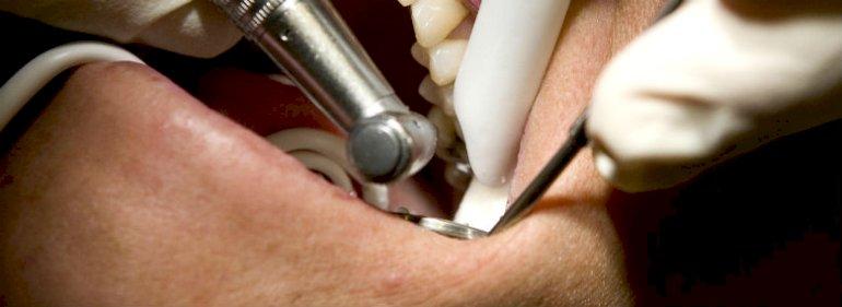 Sundhedsminister ser ingen tegn på tandlægemonopol